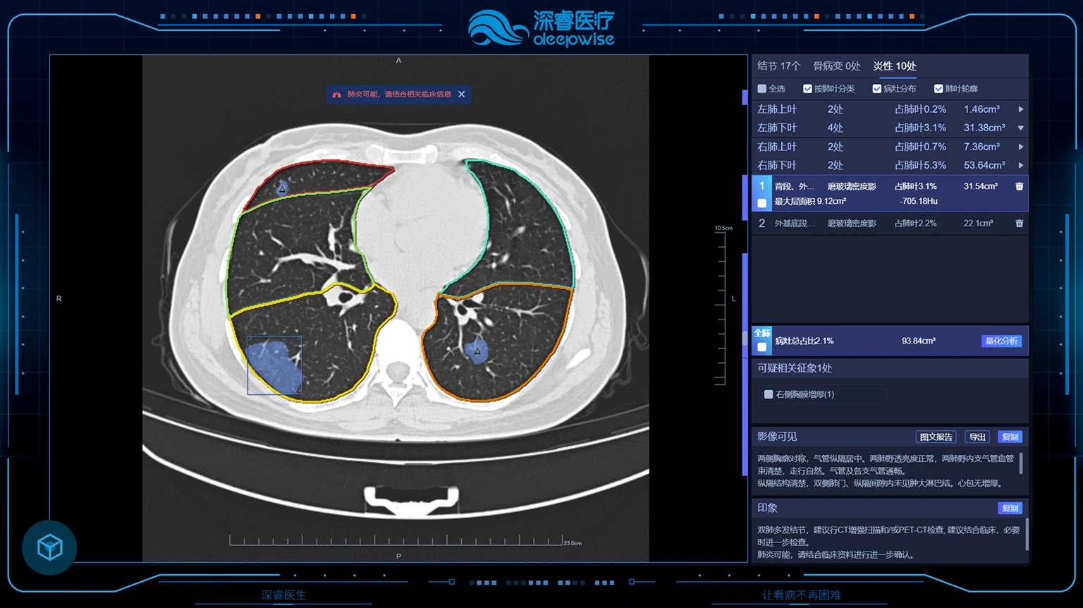 深睿医疗官方产品展示：Dr. Wise医学影像辅助分析界面